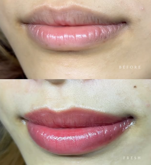 20260708_022718_lip100