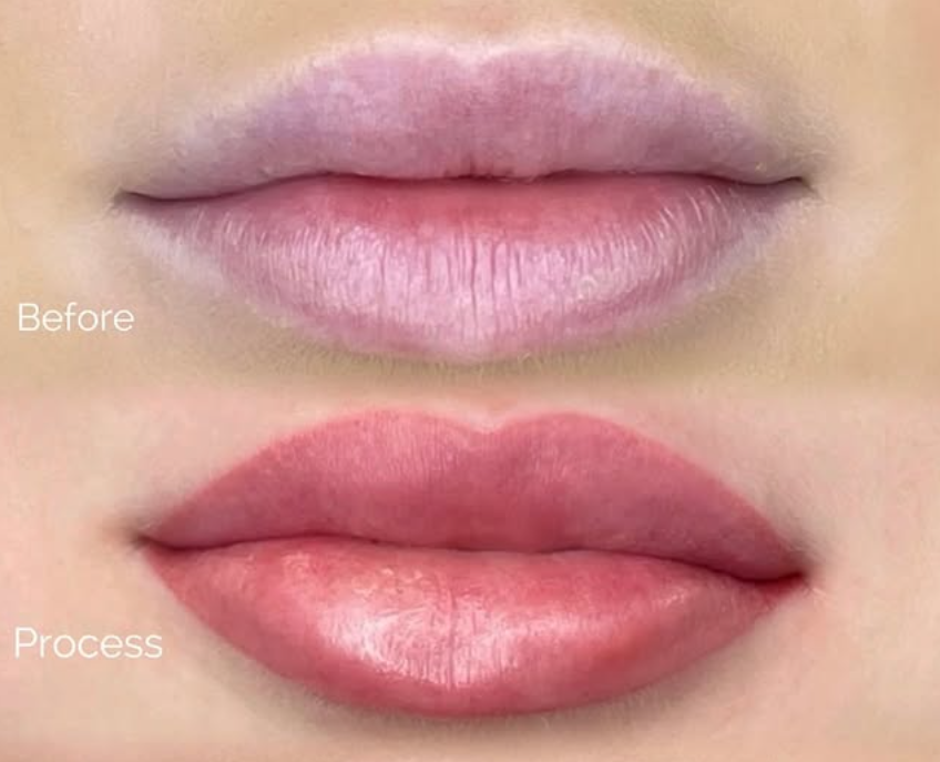 20260710_215944_lip102